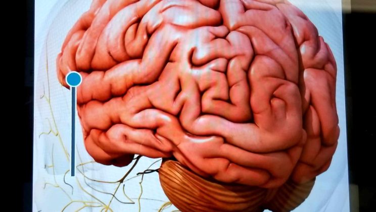 Les maladies cérébrales : causes, symptômes et quels traitements ?